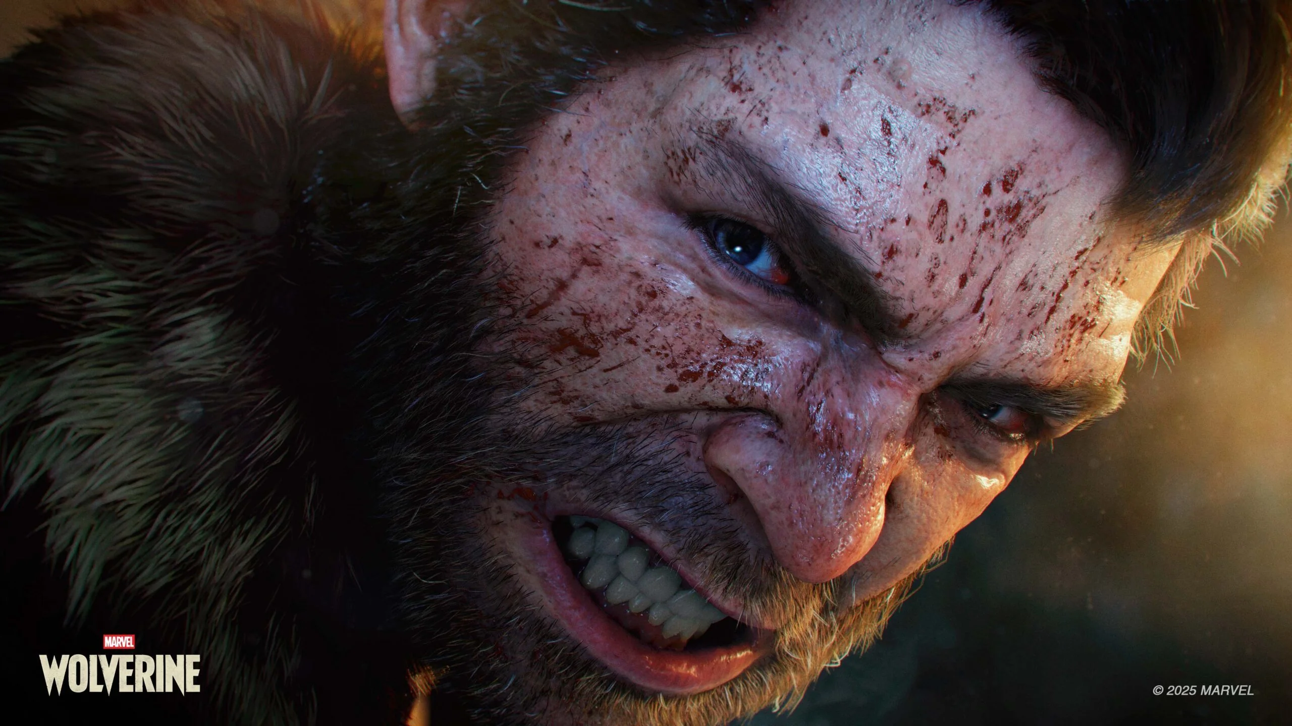 Logan ensanguentado após combate intenso em Marvel's Wolverine
